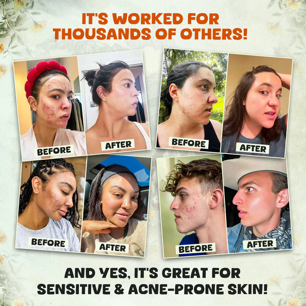 Whipped Beef Tallow & Manuka Honey Balm – Organic, All-Natural Moisturizer for Face, Body & Lips